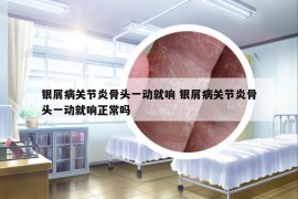 銀屑病關(guān)節(jié)炎骨頭一動(dòng)就響 銀屑病關(guān)節(jié)炎骨頭一動(dòng)就響正常嗎