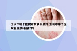 玉溪市哪個醫(yī)院看皮膚科最好 玉溪市哪個醫(yī)院看皮膚科最好的