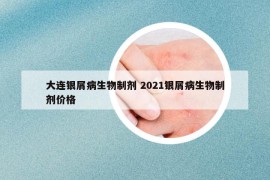 大連銀屑病生物制劑 2021銀屑病生物制劑價(jià)格