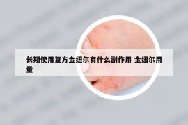 長期使用復(fù)方金紐爾有什么副作用 金紐爾用量