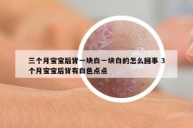 三個(gè)月寶寶后背一塊白一塊白的怎么回事 3個(gè)月寶寶后背有白色點(diǎn)點(diǎn)