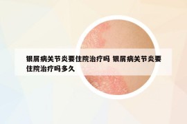 銀屑病關(guān)節(jié)炎要住院治療嗎 銀屑病關(guān)節(jié)炎要住院治療嗎多久