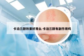 卡泊三醇效果好用么 卡泊三醇有副作用嗎