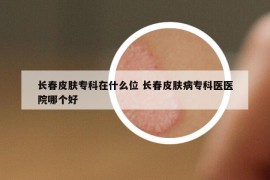 長春皮膚專科在什么位 長春皮膚病?？漆t(yī)醫(yī)院哪個好