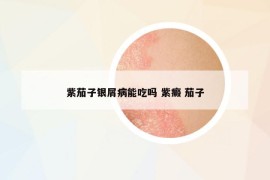 紫茄子銀屑病能吃嗎 紫癜 茄子