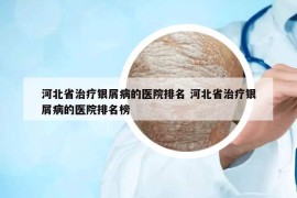 河北省治療銀屑病的醫(yī)院排名 河北省治療銀屑病的醫(yī)院排名榜
