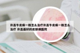 許昌牛皮癬一般怎么治療許昌牛皮癬一般怎么治療 許昌最好的皮膚病醫(yī)院