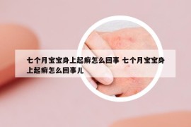 七個月寶寶身上起癬怎么回事 七個月寶寶身上起癬怎么回事兒