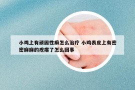 小雞上有頑固性癬怎么治療 小雞表皮上有密密麻麻的疙瘩了怎么回事