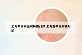 上海牛皮癬醫(yī)院特需門診 上?？磁Ｆぐ_最好的