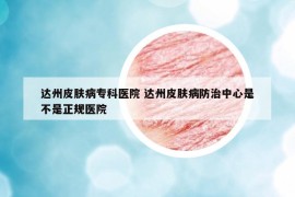 達(dá)州皮膚病專(zhuān)科醫(yī)院 達(dá)州皮膚病防治中心是不是正規(guī)醫(yī)院