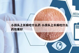 小孩頭上長癬吃什么藥 小孩頭上長癬吃什么藥效果好
