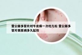 雷公藤多苷片對牛皮癬一次吃幾粒 雷公藤多苷片銀屑病多久起效