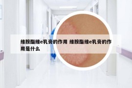 維胺酯維e乳膏的作用 維胺酯維e乳膏的作用是什么