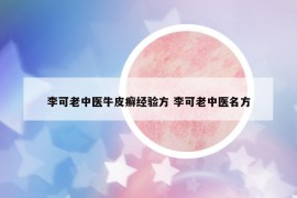 李可老中醫(yī)牛皮癬經(jīng)驗方 李可老中醫(yī)名方