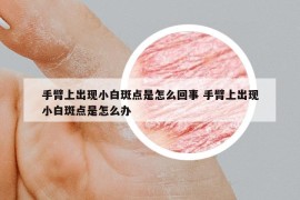 手臂上出現(xiàn)小白斑點是怎么回事 手臂上出現(xiàn)小白斑點是怎么辦