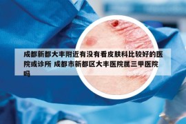 成都新都大豐附近有沒有看皮膚科比較好的醫(yī)院或診所 成都市新都區(qū)大豐醫(yī)院屬三甲醫(yī)院嗎