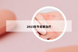 2023年牛皮癬治療