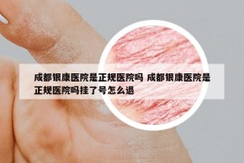 成都銀康醫(yī)院是正規(guī)醫(yī)院嗎 成都銀康醫(yī)院是正規(guī)醫(yī)院嗎掛了號怎么退