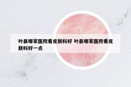 葉縣哪家醫(yī)院看皮膚科好 葉縣哪家醫(yī)院看皮膚科好一點
