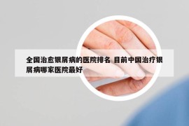 全國治愈銀屑病的醫(yī)院排名 目前中國治療銀屑病哪家醫(yī)院最好
