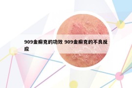 909金癬克的功效 909金癬克的不良反應(yīng)
