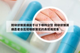 斑塊狀銀屑病屬于以下哪種分型 斑塊狀銀屑病患者會出現(xiàn)哪些常見的表現(xiàn)或現(xiàn)象