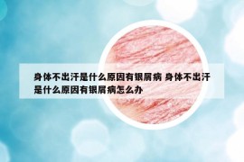 身體不出汗是什么原因有銀屑病 身體不出汗是什么原因有銀屑病怎么辦