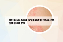 哈爾濱市趙永珍皮膚專家怎么治 趙永厚皮膚醫(yī)院地址哈爾濱