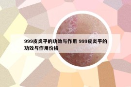 999皮炎平的功效與作用 999皮炎平的功效與作用價格