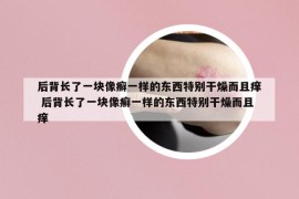 后背長(zhǎng)了一塊像癬一樣的東西特別干燥而且癢 后背長(zhǎng)了一塊像癬一樣的東西特別干燥而且癢