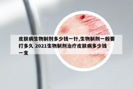皮膚病生物制劑多少錢一針,生物制劑一般要打多久 2021生物制劑治療皮膚病多少錢一支