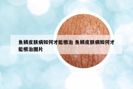 魚(yú)鱗皮膚病如何才能根治 魚(yú)鱗皮膚病如何才能根治圖片