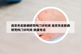 南京市皮膚病研究所門診時間 南京市皮膚病研究所門診時間 膚康電話