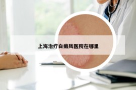 上海治療白癜風醫(yī)院在哪里