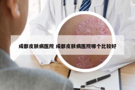 成都皮膚病醫(yī)院 成都皮膚病醫(yī)院哪個比較好