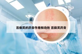 百癬靈的藥膏作用和功效 百蘚靈藥膏