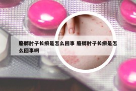 胳膊肘子長(zhǎng)癬是怎么回事 胳膊肘子長(zhǎng)癬是怎么回事啊