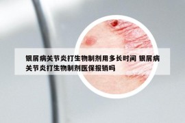 銀屑病關(guān)節(jié)炎打生物制劑用多長時間 銀屑病關(guān)節(jié)炎打生物制劑醫(yī)保報銷嗎
