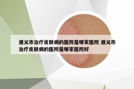 遵義市治療皮膚病的醫(yī)院是哪家醫(yī)院 遵義市治療皮膚病的醫(yī)院是哪家醫(yī)院好