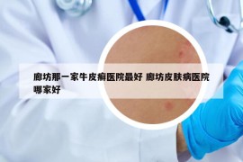 廊坊那一家牛皮癬醫(yī)院最好 廊坊皮膚病醫(yī)院哪家好