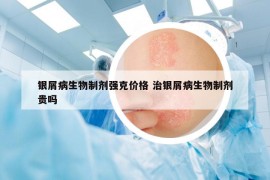 銀屑病生物制劑強(qiáng)克價格 治銀屑病生物制劑貴嗎