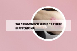 2023銀屑病國家有補(bǔ)貼嗎 2021銀屑病國家免費治療