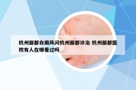 杭州麗都白癜風問杭州麗都診治 杭州麗都醫(yī)院有人在哪看過嗎