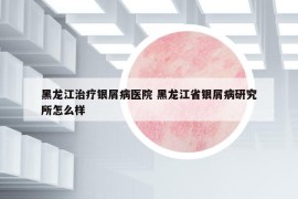 黑龍江治療銀屑病醫(yī)院 黑龍江省銀屑病研究所怎么樣