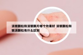 消銀顆粒和消銀顆片哪個效果好 消銀顆粒和銀消顆粒有什么區(qū)別