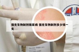 強克生物制劑銀屑病 強克生物制劑多少錢一支