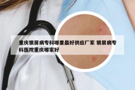 重慶銀屑病專(zhuān)科哪里最好供應(yīng)廠家 銀屑病專(zhuān)科醫(yī)院重慶哪家好