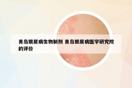 青島銀屑病生物制劑 青島銀屑病醫(yī)學(xué)研究院的評(píng)價(jià)