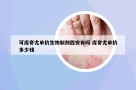 可庫(kù)奇尤單抗生物制劑西安有嗎 庫(kù)奇尤單抗多少錢